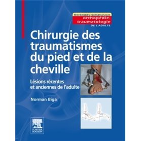 Chirurgie des traumatismes du pied et de la cheville