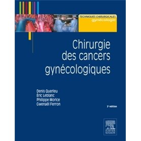 Chirurgie des cancers gynécologiques