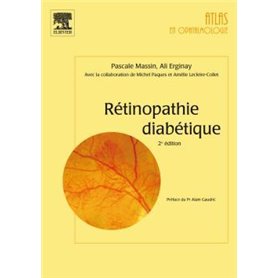 Rétinopathie diabétique