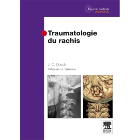 Traumatologie du rachis