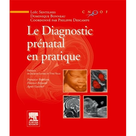 Le diagnostic prénatal en pratique