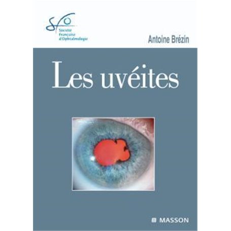 Les uvéites