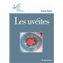 Les uvéites