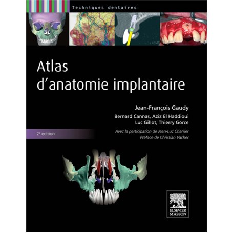 Atlas d'anatomie implantaire