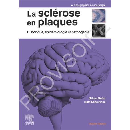 La sclérose en plaques - Historique, épidémiologie et pathogénie