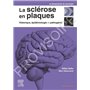 La sclérose en plaques - Historique, épidémiologie et pathogénie