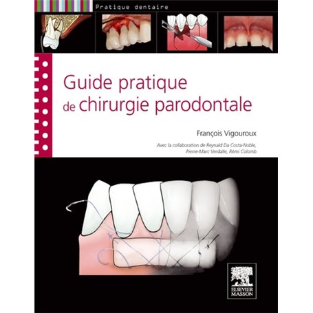 Guide pratique de chirurgie parodontale