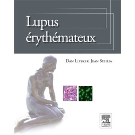 Lupus érythémateux