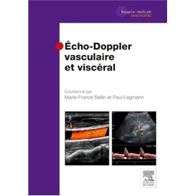 Echo-Doppler vasculaire et viscéral