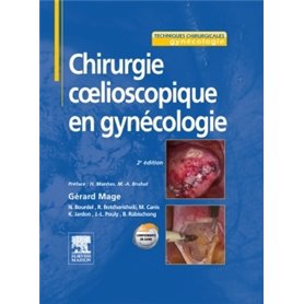 Chirurgie coelioscopique en gynécologie