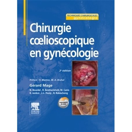 Chirurgie coelioscopique en gynécologie