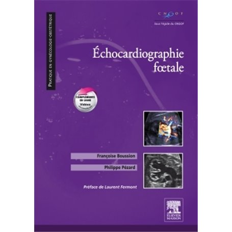 Echocardiographie foetale