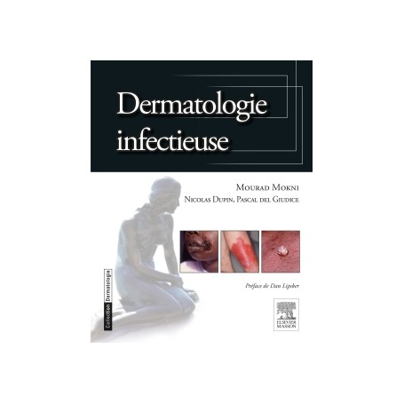 Dermatologie infectieuse