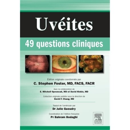 Uvéites : 49 questions cliniques