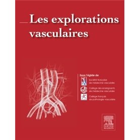 Les explorations vasculaires