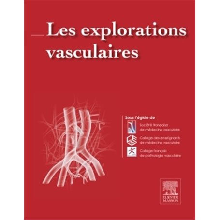 Les explorations vasculaires