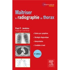 Maîtriser la radiographie du thorax