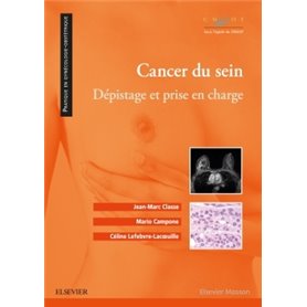 Cancer du sein