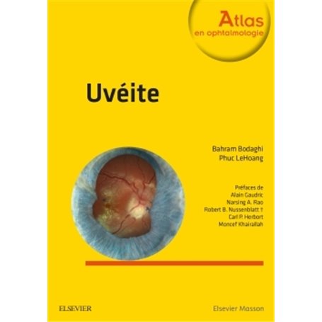 Uvéite