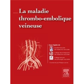 La maladie thrombo-embolique veineuse