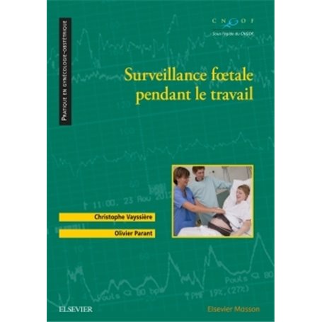 Surveillance foetale pendant le travail