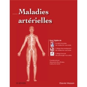 Maladies artérielles