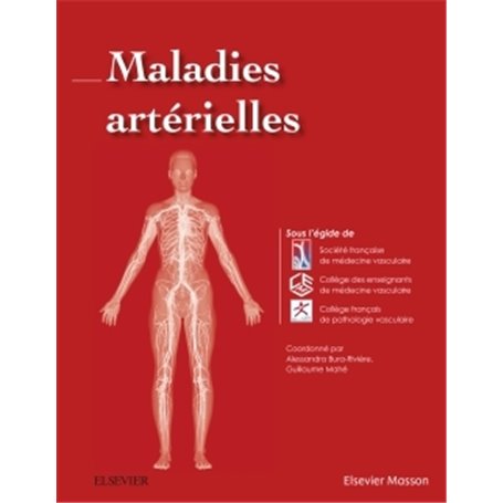 Maladies artérielles