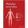 Maladies artérielles