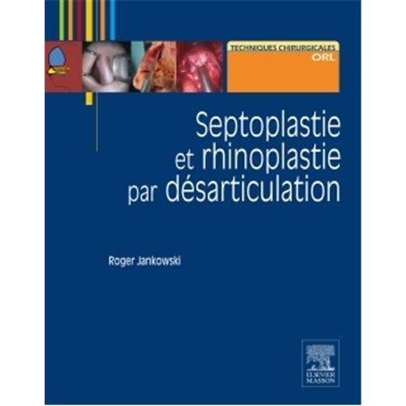 Septoplastie et rhinoplastie par désarticulation