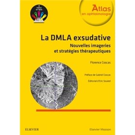 La DMLA exsudative