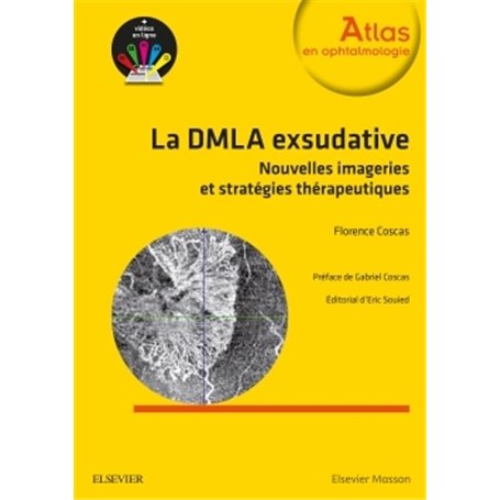 La DMLA exsudative