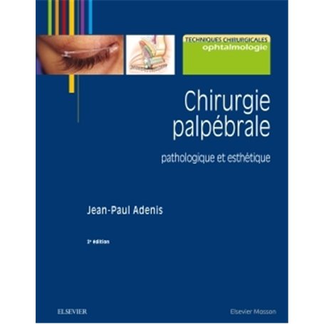 Chirurgie palpébrale