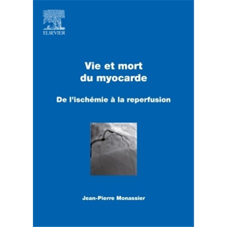 Vie et mort du myocarde