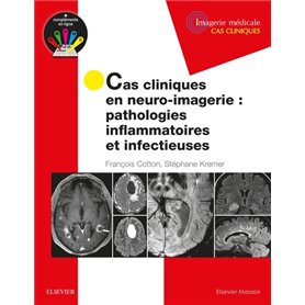 Cas cliniques en neuro-imagerie : pathologies inflammatoires et infectieuses