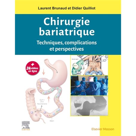 Chirurgie bariatrique