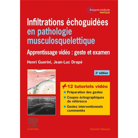 Infiltrations échoguidées en pathologie musculosquelettique