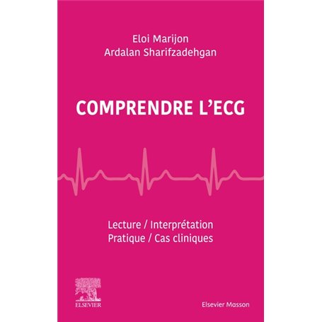 Comprendre l'ECG