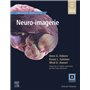 Neuro-imagerie