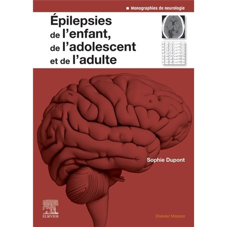 Epilepsies de l'enfant, de l'adolescent et de l'adulte