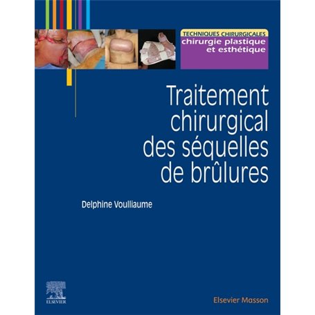 Traitement chirurgical des séquelles des brûlures