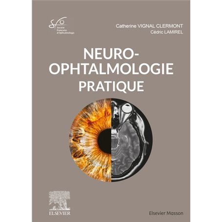 Neuro-ophtalmologie pratique