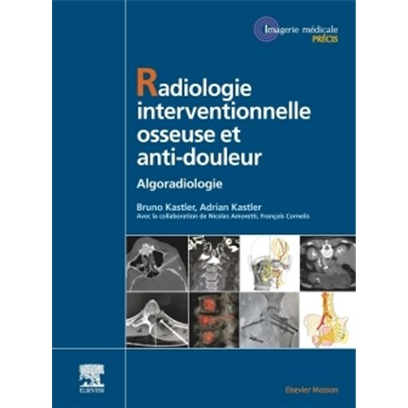 Radiologie Interventionnelle osseuse et anti-douleur