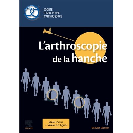 L'arthroscopie de la hanche