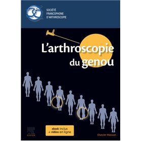 L'arthroscopie du genou