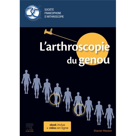 L'arthroscopie du genou