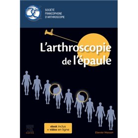 L'arthroscopie de l'épaule