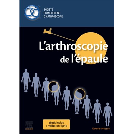 L'arthroscopie de l'épaule