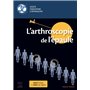 L'arthroscopie de l'épaule