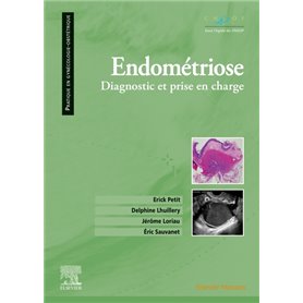 Endométriose