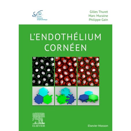 L'endothélium cornéen